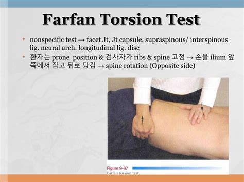 farfan torsion test on pars articularis|farfan's torsion test.